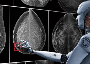 Narzędzie AI wykrywa oznaki raka, których nie zauważyli lekarze