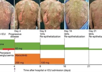 Naukowcy odkrywają potencjał inhibitorów JAK w leczeniu zagrażającej życiu choroby skóry