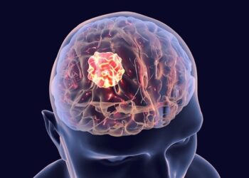 Międzynarodowy zespół przedstawia zalecenia dotyczące wykorzystania sztucznej inteligencji w neuroonkologii