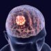 Międzynarodowy zespół przedstawia zalecenia dotyczące wykorzystania sztucznej inteligencji w neuroonkologii