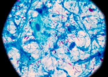 Rozszyfrowanie mechanizmów odpowiedzi immunologicznej za pomocą probabilistycznych sieci graficznych