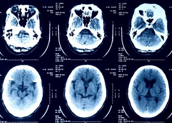 Uwaga: Nie przesyłaj swoich zdjęć medycznych do czatbotów AI