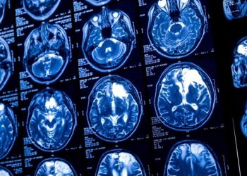 "Wykrywanie kamuflażu usprawnia sieci neuronowe w diagnozowaniu guzów mózgu"