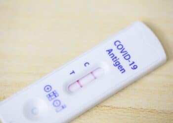 Związek między COVID-19 a długoterminowym ryzykiem chorób autoimmunologicznych i autozapalnych tkanki łącznej