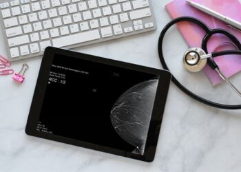 Jak sztuczna inteligencja ulepsza przewidywanie ryzyka raka piersi na podstawie gęstości mammograficznej