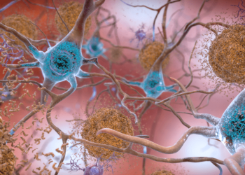 Nowa szczepionka z nanowłókien ma chronić przed demencją bez wywoływania stanu zapalnego