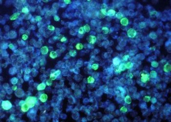 Około 20% osób poniżej 50. roku życia na świecie żyje z wirusem opryszczki narządów płciowych (HSV)