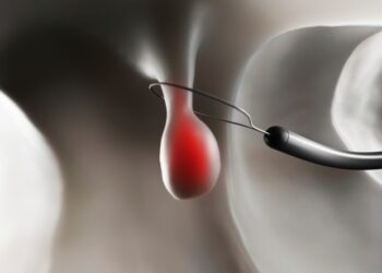 Podczas badania kolonoskopii szpital naliczył opłatę 19 000 dolarów za dwa zabiegi.