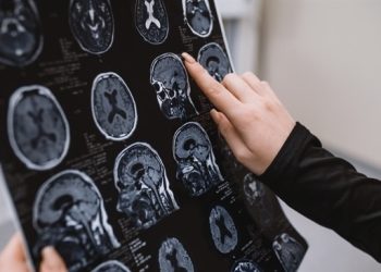Przenośne MRI i sztuczna inteligencja usprawniają diagnostykę Alzheimera dzięki precyzji i niskim kosztom