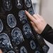 Przenośne MRI i sztuczna inteligencja usprawniają diagnostykę Alzheimera dzięki precyzji i niskim kosztom
