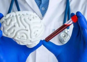 Badanie krwi może pomóc we wczesnym wykrywaniu choroby Alzheimera