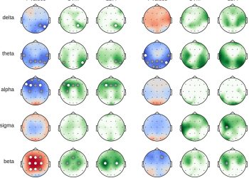 Kofeina zwiększa złożoność pracy mózgu podczas snu i przesuwa ją w kierunku stanu krytycznego