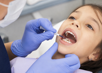 Dentysta nakłada fluorek diaminy srebra na ubytek bez użycia wiertła