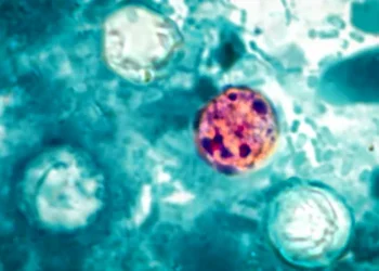 Ponad 400 osób chorych w wyniku tajemniczej epidemii