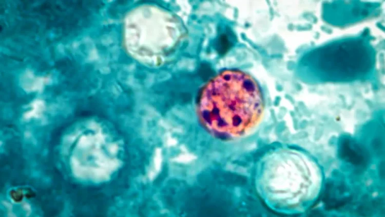 Ponad 400 osób chorych w wyniku tajemniczej epidemii
