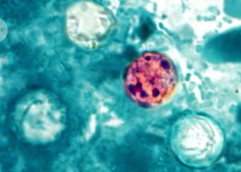 Eksperci szukają źródła epidemii groźnej biegunki w USA