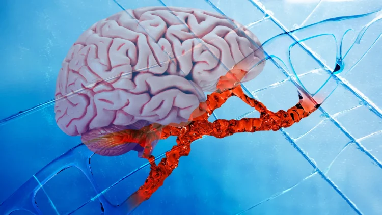 Nowy lek na Alzheimera naprawia DNA i hamuje stan zapalny mózgu